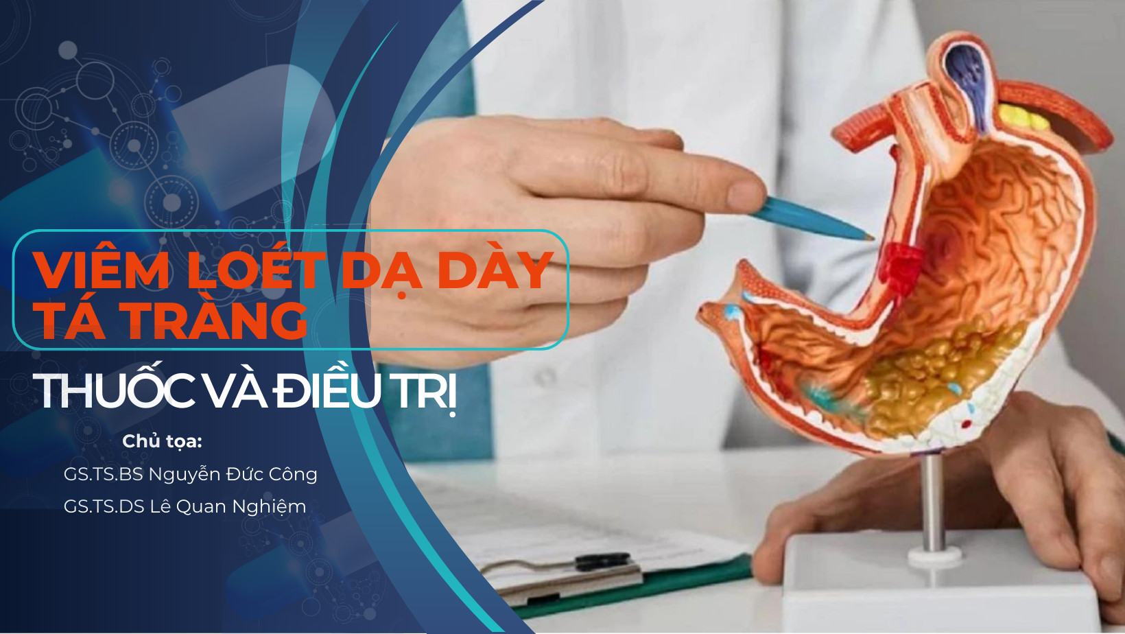 Viêm loét dạ dày tá tràng - Thuốc và điều trị